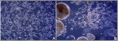 Genetic diversity among reptilian orthoreoviruses isolated from pet snakes and lizards